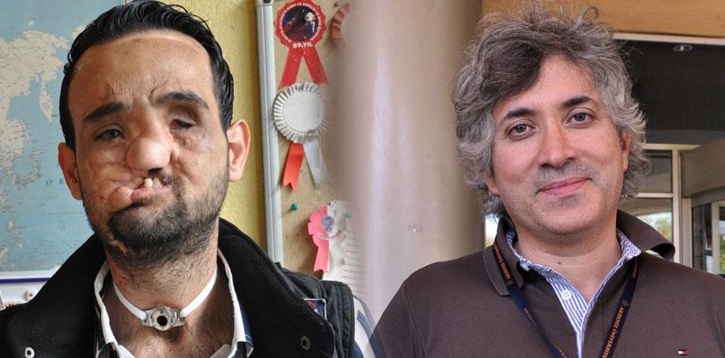 Yüz nakli olan Recep Sert'in yüzünde tuz şüphesi