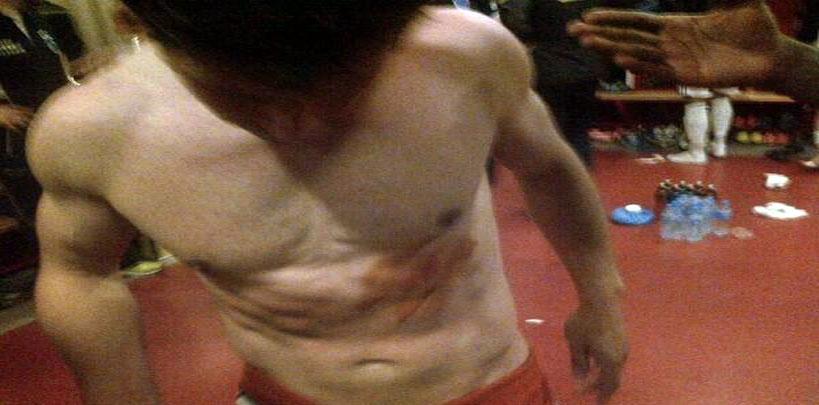 Zokora'nın tekmesi bu hale getirdi