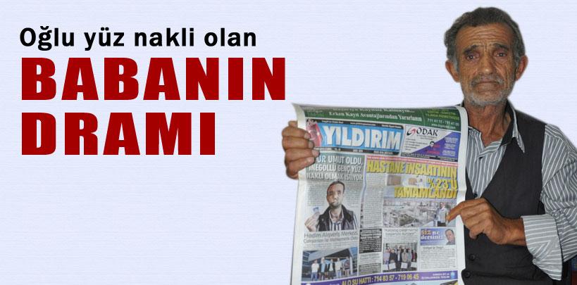 Oğlu yüz nakli olan babanın dramı
