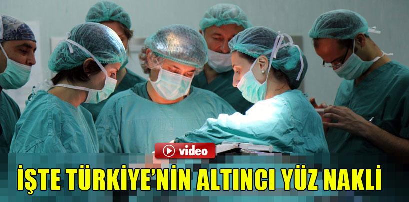 Türkiye'nin altıncı yüz nakli görüntüleri basınla paylaşıldı