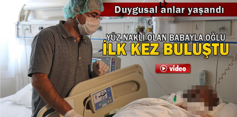 Yüz nakli olan babayla oğulun ilk buluşmasında duygusal anlar