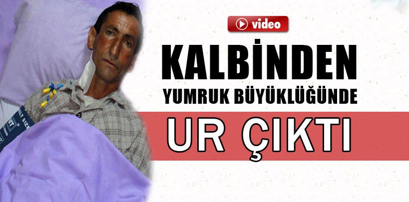 Kalbinden yumruk büyüklüğünde ur çıktı