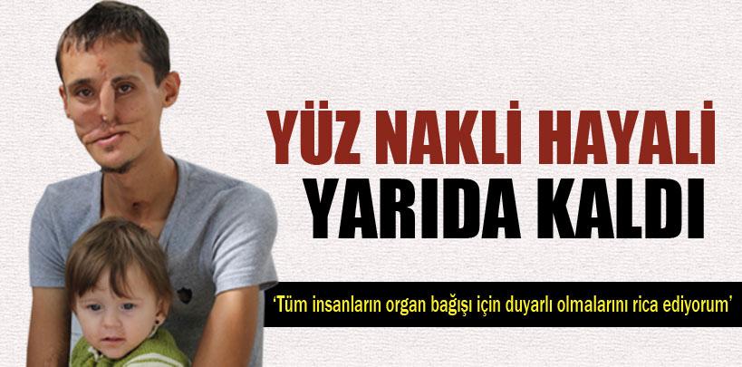 Yüz nakli olmak isteyen Recep'in hayali yarıda kaldı